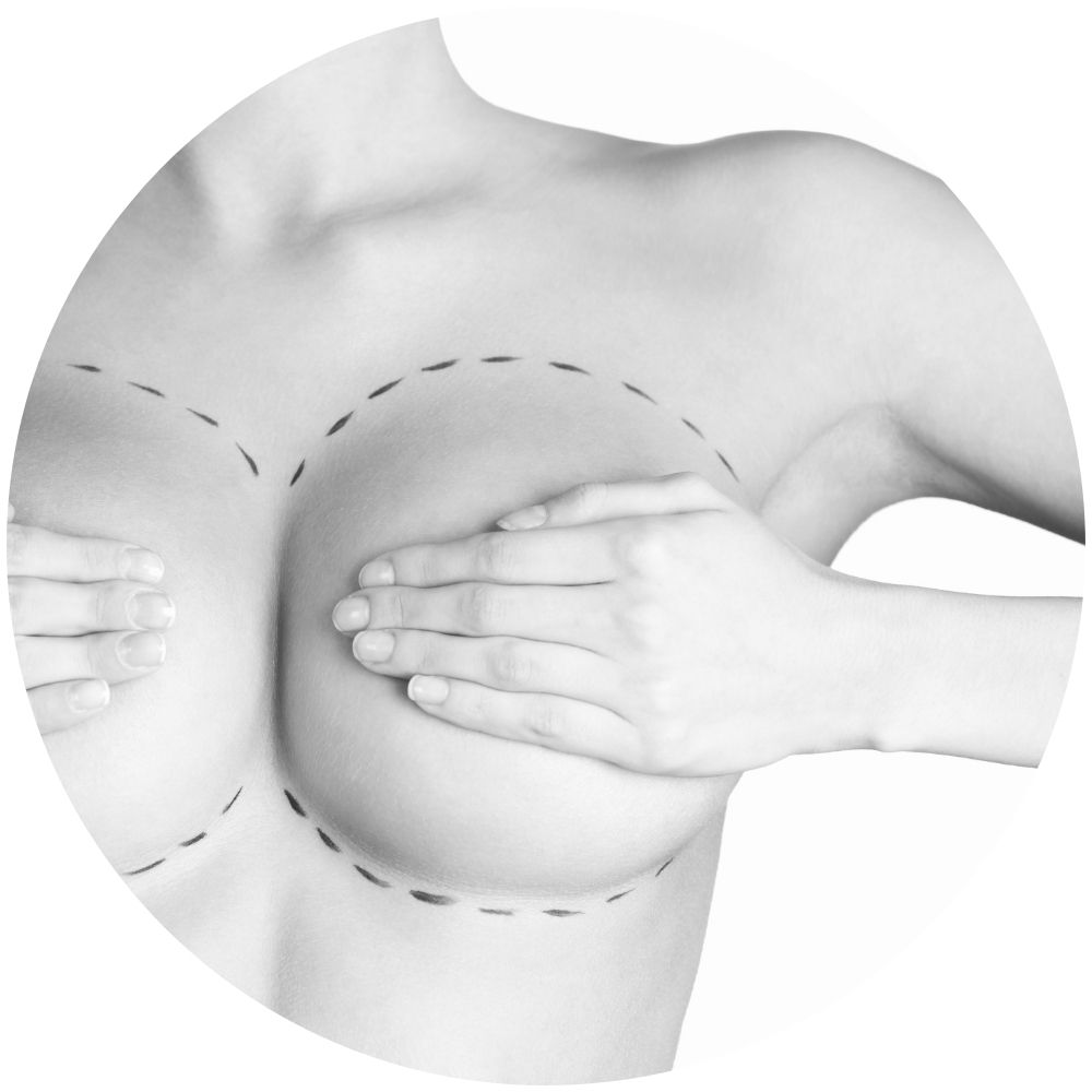 brustvergroesserung mit implantaten mammaaugmentation basel